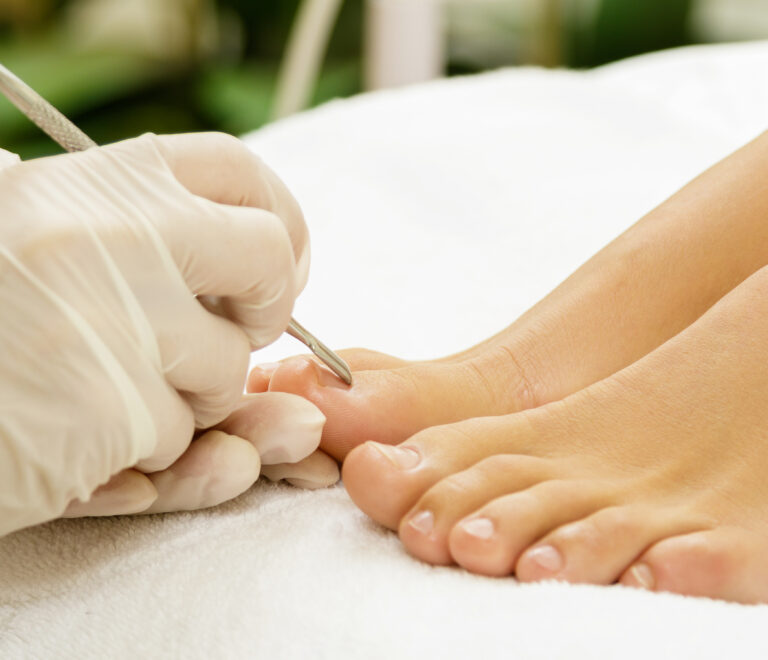 Protetika nokta – Obnova i zaštita oštećenih noktiju