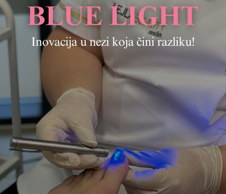 Blue Light tretman za urasle nokte