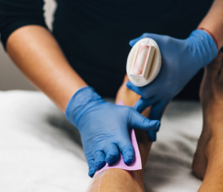 Depilacija toplim voskom